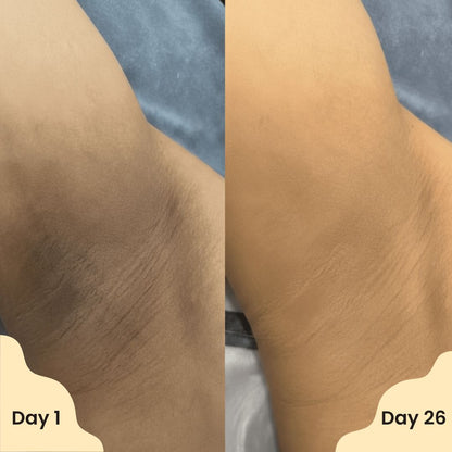 ✨ Zyvenex® Vanilla Pistachio Brightening Deodorant — Smooth skin Underarms in Just Weeks 💛 ✨