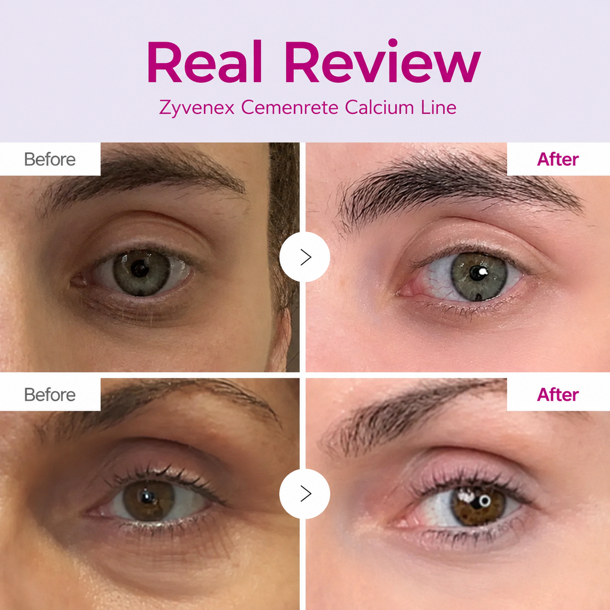 🔥LAST DAY 50% OFF!!Zyvenex Korean Calcium Dark Spot Eye Cream