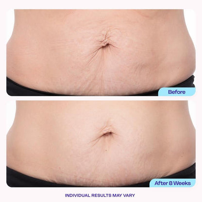 Tighten & Smooth Belly Cream