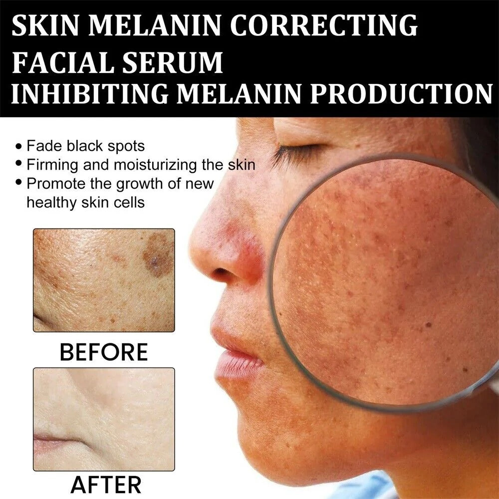 ✨Zyvenex Niacinamide Brightening Serum
