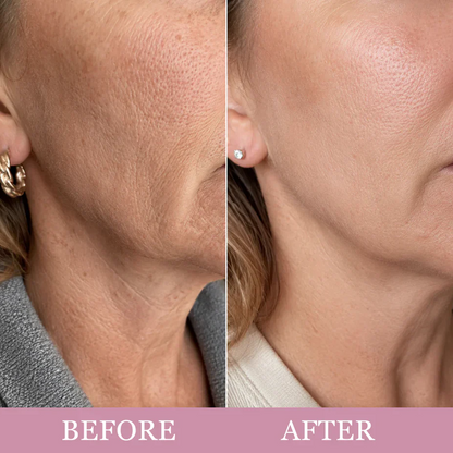 🔥LAST DAY 50% OFF!!✨🦢Neck Wrinkle Eraser! Built-In Gua Sha Cream w/5% Anemarrhena Root Complex + PDRN Korean Skincare